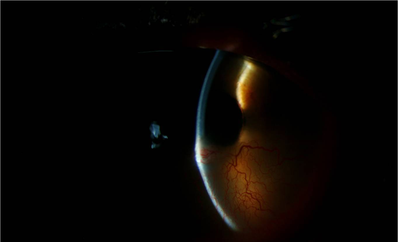 External and anterior segment examination